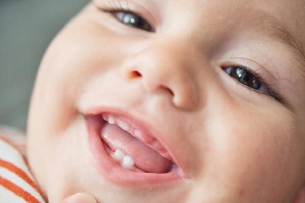 دندان نوزادان دندان نوزادان,دندان نوزادان پر استرس