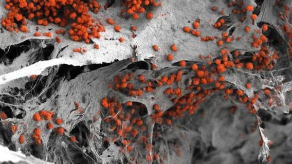 سرطان خون,فناوری برای سرطان خون