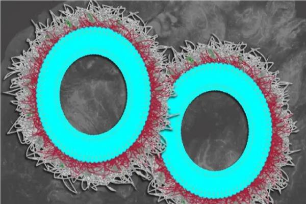 تومورهای تخمدان تومورهای تخمدان,نابودی بیش از ۸۰ درصدی تومورهای تخمدان با نانوذرات جدید