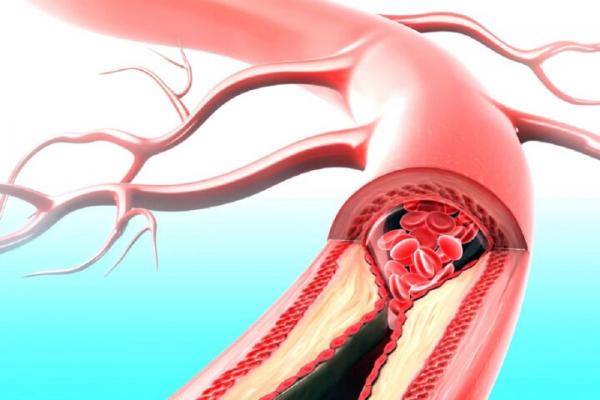 بیماری قلبی و دیابت بیماری قلبی و دیابت,داروی مقابله با بیماری قلبی و دیابت