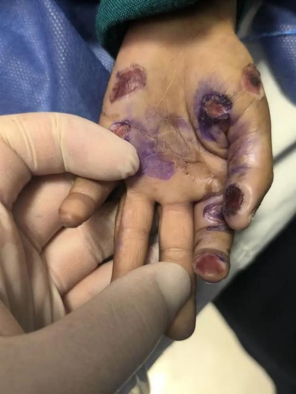 کودک آزاری کودک آزاری,کودکآزاری منجر به فوت در هرمزگان