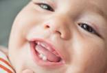 دندان‌ نوزادان,دندان‌ نوزادان پر استرس