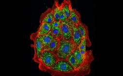 دانشمندان آسیب کلیوی را در موشها معکوس کردند کلیوی,آسیب کلیوی