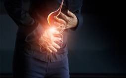 زخم معده پس از درمان کامل نیاز به مصرف طولانیمدت دارو ندارد زخم معده,دانستنی درباره زخم معده