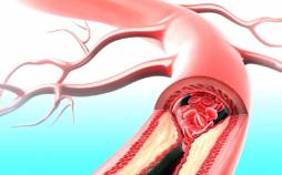 بیماری قلبی و دیابت,داروی مقابله با بیماری قلبی و دیابت