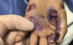 کودکآزاری منجر به فوت در هرمزگان کودک آزاری,کودکآزاری منجر به فوت در هرمزگان