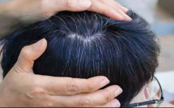 یافتهای جدید درباره سفید شدن مو سفیدی مو,یافتهای جدید درباره سفید شدن مو