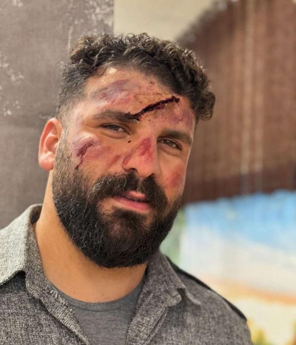 میلاد کرمی میلاد کرمی,سقوط میلاد کرمی بلاگر معروف اینستاگرامی در کوهستان