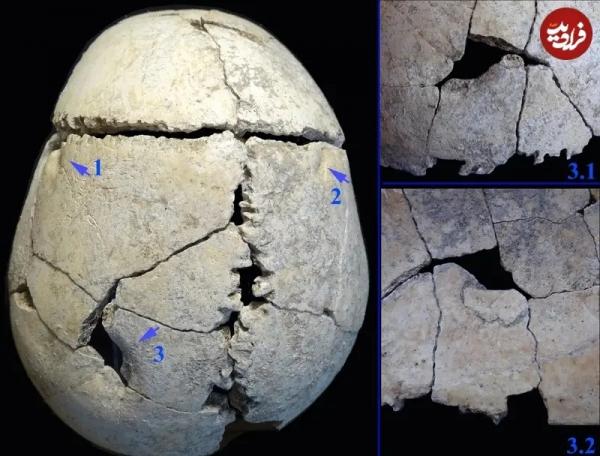 اسکلت اسکلت,کشف اسکلت یک نوجوان