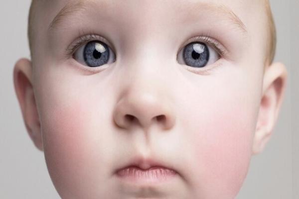 زوال عقل زوال عقل,زوال عقل از کودکی