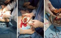 خرمالو,ماجرای خرمالو در اتاق‌های عمل مشهد