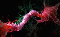 مبارزه با پیری مغز با کاهش ۳۰ درصدی کالری دریافتی مغز,مبارزه با پیری مغز