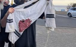 تیراندازی مرگبار در جشن یهودیان استرالیا | ۱۲۰ کشته و زخمی | کشته شدن یک خاخام معروف اسرائیلی تیراندازی در جریان یک جشن یهودی در استرالیا,حمله به جشن یهودیان در استرالیا