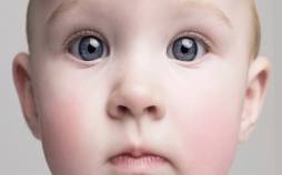 زوال عقل از کودکی میآید زوال عقل,زوال عقل از کودکی