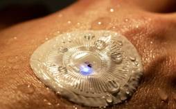 آلزایمر,تشخیص آلزایمر و پارکینسون از عرق بدن