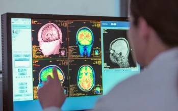 مغز در طول,بررسی مغز در طول