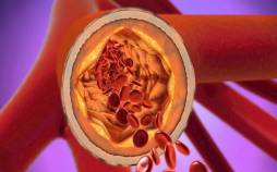 کلسترول,بیماری قلبی و کلسترول