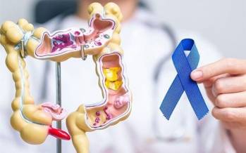 سرطان روده بزرگ,عامل پنهان افزایش سرطان روده بزرگ در سنین پایین