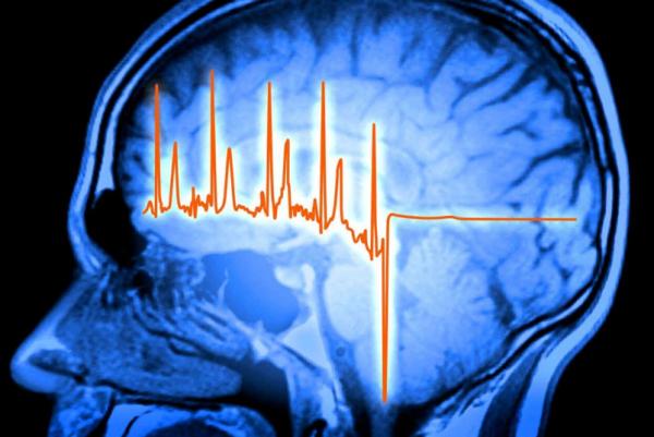 مغز و قلب,کشف ارتباط شگفت‌انگیز مغز و قلب در بهبود پس از سکته قلبی