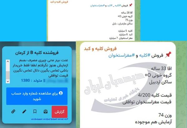 فروش کلیه در ایران,سیل فروش کلیه در ایران بخاطر نیاز مالی