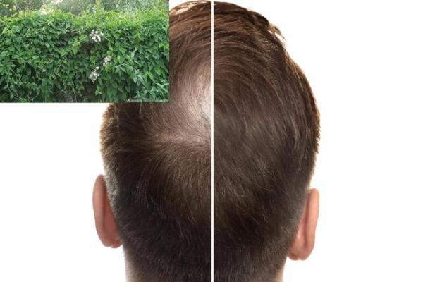 رشد مو,گیاهی برای رشد مجدد مو