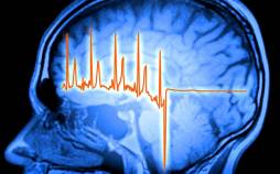 کشف ارتباط شگفتانگیز مغز و قلب در بهبود پس از سکته قلبی مغز و قلب,کشف ارتباط شگفتانگیز مغز و قلب در بهبود پس از سکته قلبی