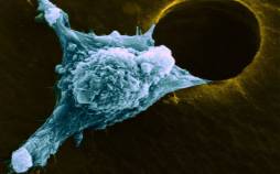 سرطان,تشخیص سرطان