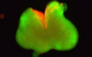 دستاوردی قابل توجه در ترمیم نخاع,کشف جدید برای ترمیم نخاع