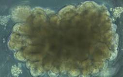 دانشمندان «مینیمغز» ساختند و به آن حل مسئله یاد دادند مینیمغز,ساخت مینی مغز توسط دانشمندان