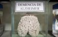 اخبار جالب,خبرهای جالب,خواندنی ها و دیدنی ها,موزه مغز های واقعی انسان