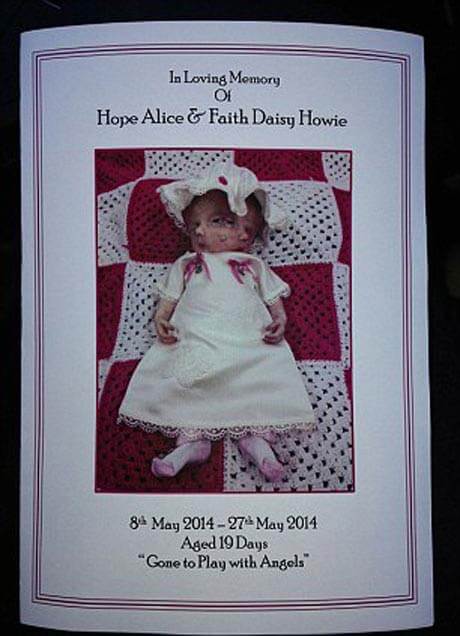 اخبار جالب,خبرهای جالب,خواندنی ها و دیدنی ها,عکس های مراسم تدفین دوقلوی به هم چسبیده