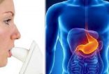 اخبار پزشکی,خبرهای پزشکی,تازه های پزشکی,تست تنفس سرطان معده