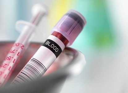 اخبار پزشکی,خبرهای پزشکی,تازه های پزشکی,تشخیص محل رشد تومور در بدن