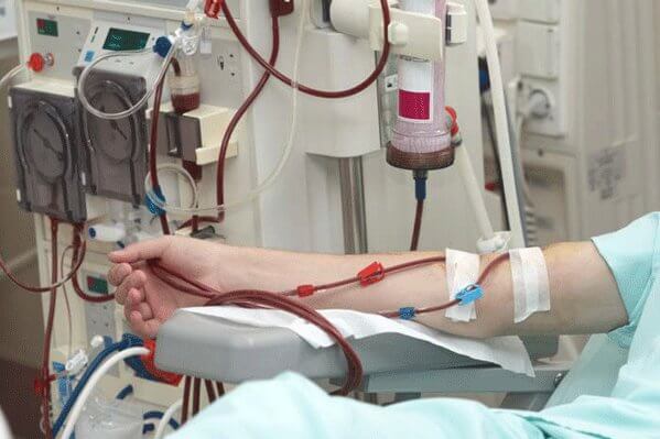 فروش کلیه،بهداشت،خبرهای پزشکی،اخبار پزشکی اخبار پزشکی,خبرهای پزشکی,بهداشت,فروش کلیه