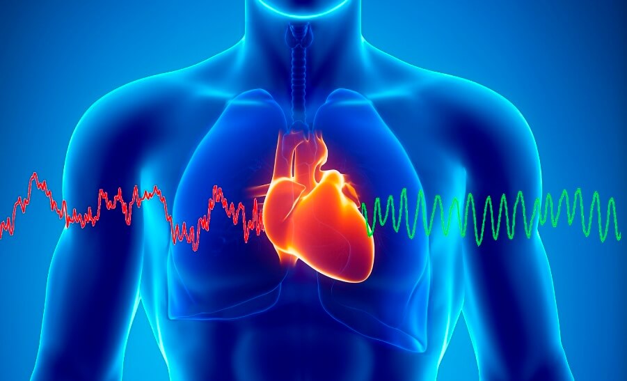 اخبار پزشکی,خبرهای پزشکی,مشاوره پزشکی,ایست قلبی