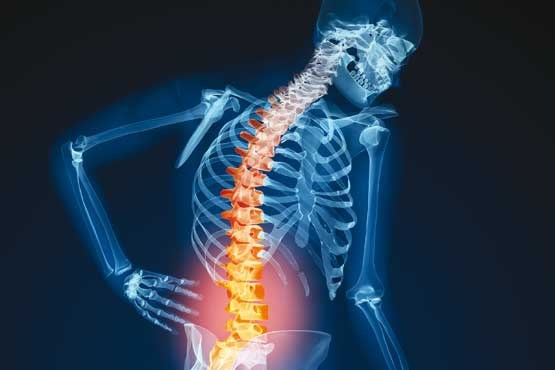 اخبار پزشکی,خبرهای پزشکی,مشاوره پزشکی,کمردرد