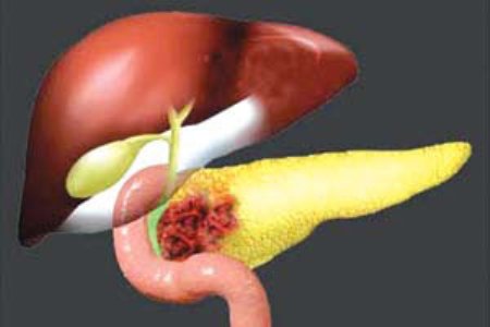 لوزالمعده،مشاوره پزشکی،خبرهای پزشکی،اخبار پزشکی اخبار پزشکی,خبرهای پزشکی,مشاوره پزشکی,لوزالمعده