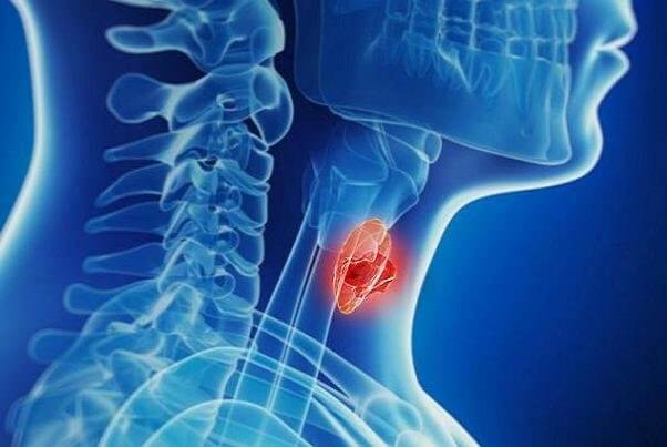 سرطان تیروئید،تازه های پزشکی،خبرهای پزشکی،اخبار پزشکی اخبار پزشکی,خبرهای پزشکی,تازه های پزشکی,سرطان تیروئید