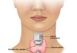 اخبار پزشکی,خبرهای پزشکی,مشاوره پزشکی,اختلالات تیروئید