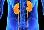 اخبار پزشکی,خبرهای پزشکی,مشاوره پزشکی,کلیه