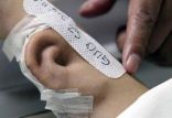 اخبار پزشکی,خبرهای پزشکی,تازه های پزشکی,گوش مصنوعی
