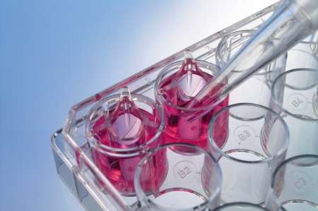 اخبار پزشکی,خبرهای پزشکی,مشاوره پزشکی,سلول های بنیادی