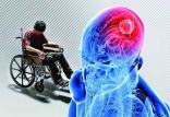 اخبار پزشکی,خبرهای پزشکی,تازه های پزشکی,بیماری ام‌اس