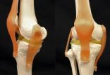 اخبار پزشکی,خبرهای پزشکی,مشاوره پزشکی,غضروف زانو
