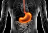 اخبار پزشکی,خبرهای پزشکی,مشاوره پزشکی,مشکلات گوارشی
