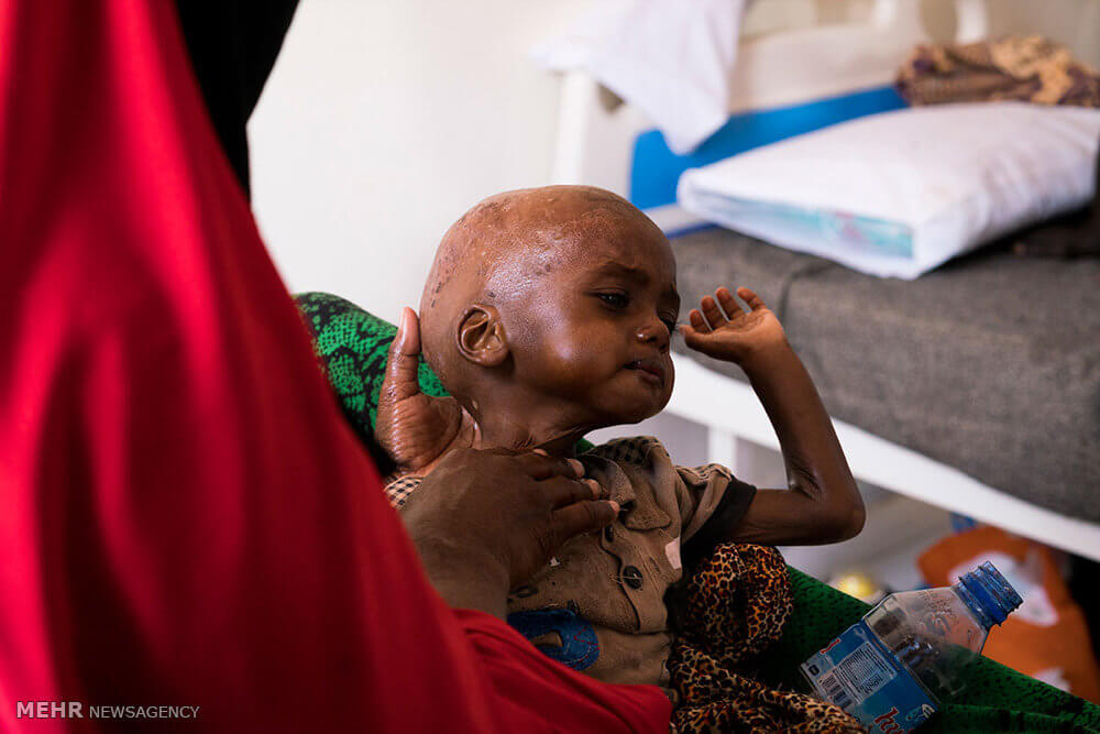 تصاویر قحطی در سومالی,عکس های خشکسالی و گرسنگی سومالی ها,عکس مقابله با گرسنگی در سومالی
