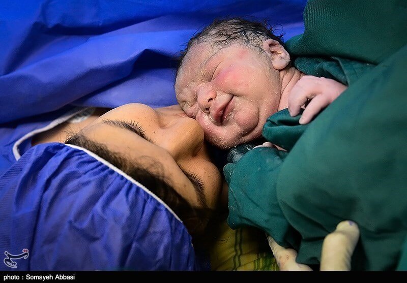 اخبار پزشکی,خبرهای پزشکی,مشاوره پزشکی,عمل سزارین