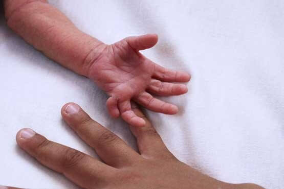اخبار اجتماعی,خبرهای اجتماعی,خانواده و جوانان,نوزاد ۶ انگشتی