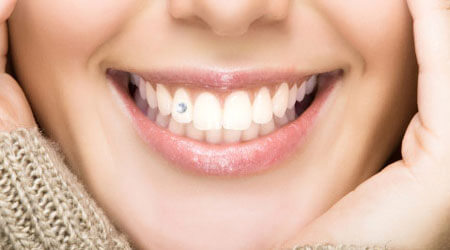 از دست دادن دندان،تازه های پزشکی،خبرهای پزشکی،اخبار پزشکی اخبار پزشکی,خبرهای پزشکی,تازه های پزشکی,از دست دادن دندان