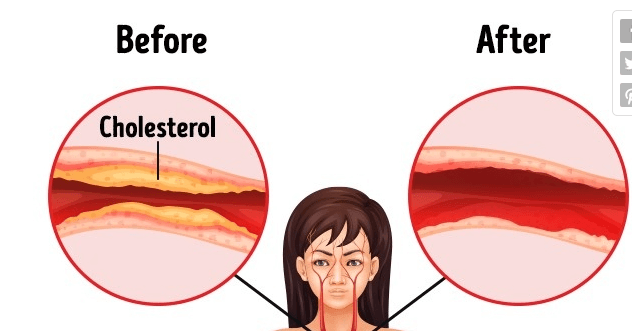 اخبار پزشکی,خبرهای پزشکی,بهداشت,خواص بادام